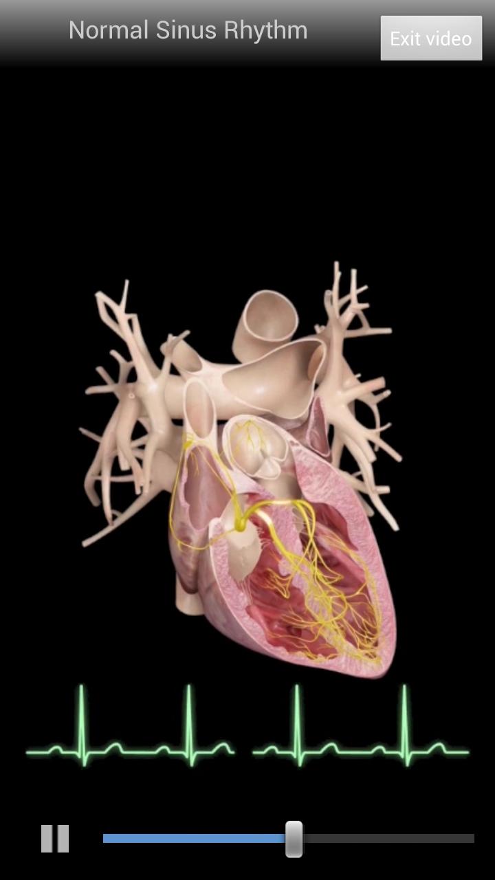 Cardiological