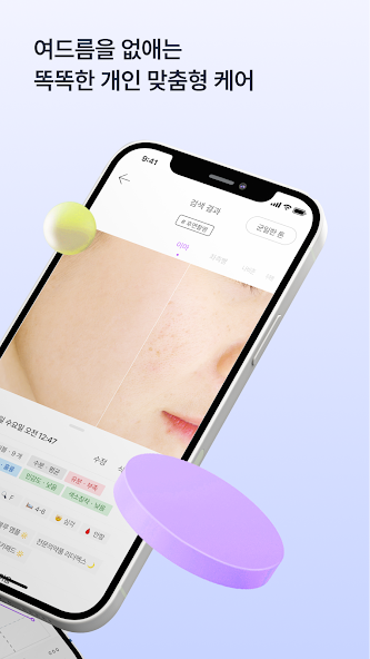 SkinLog | Acne diary