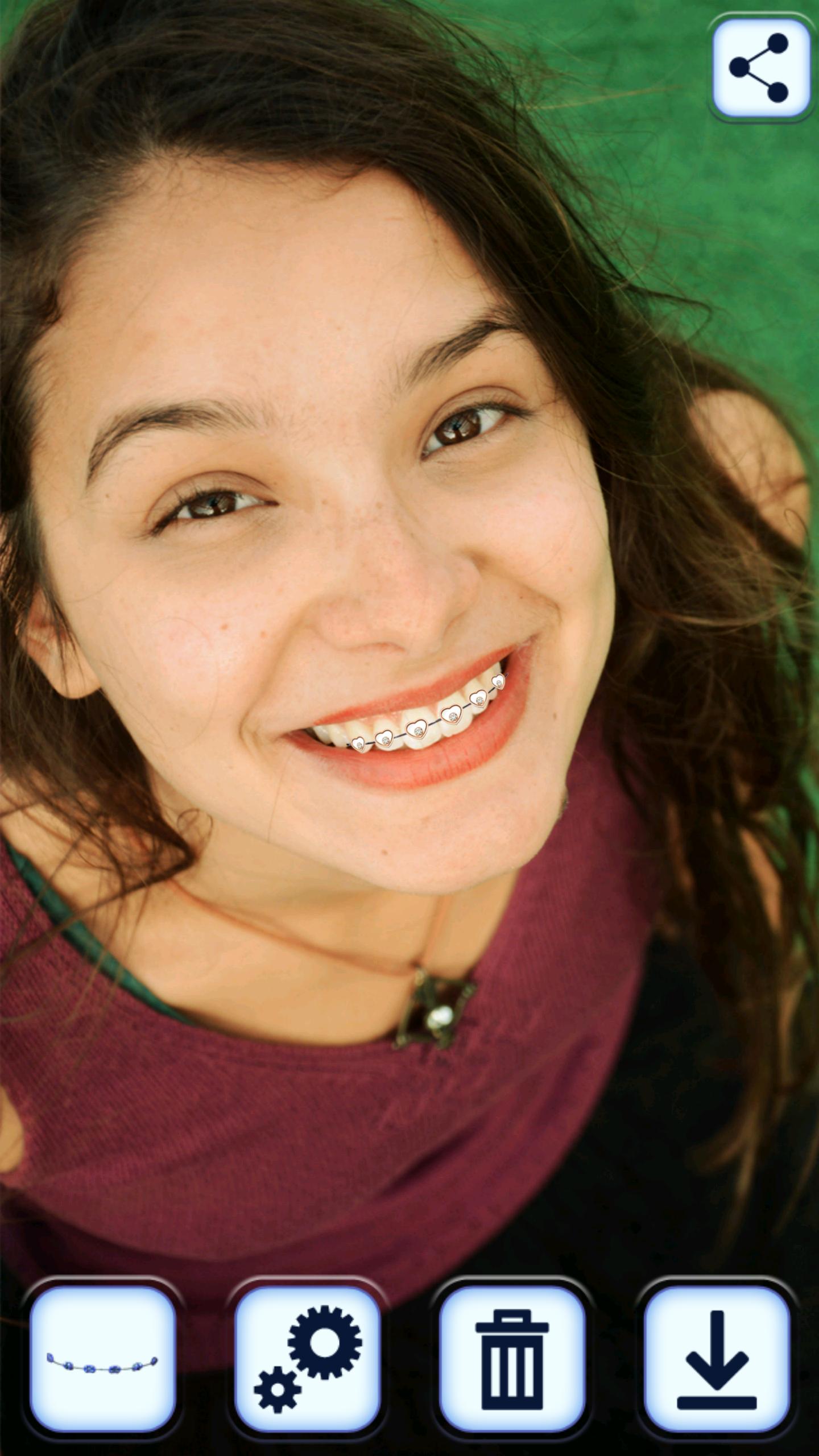 Braces App for Teeth That Look Real