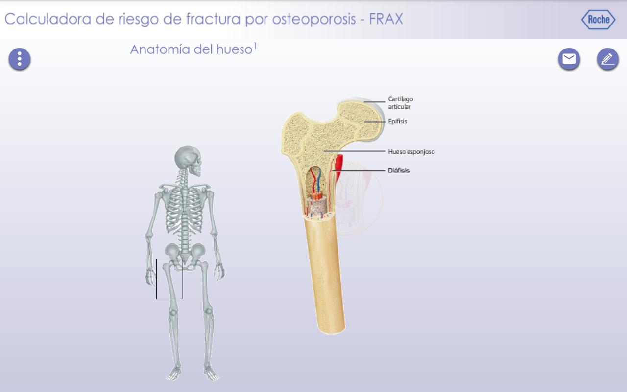 Calculadora FRAX Bonviva